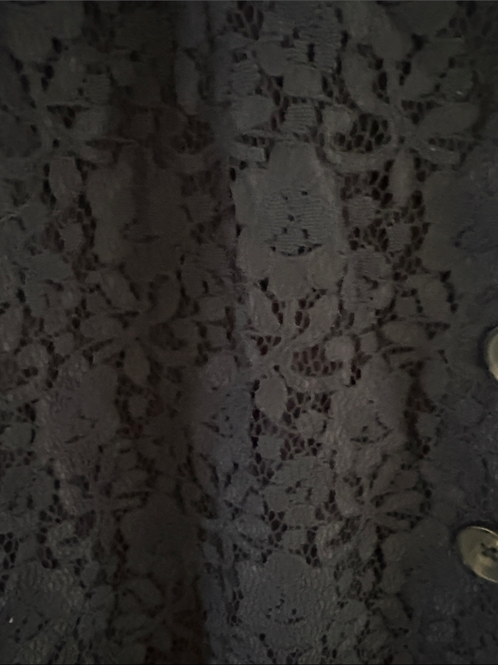 Abercrombie & Fitch Navy Lace Button-Front Mini Dress - Picture 5 of 8